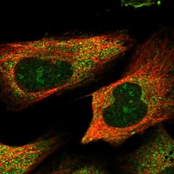 Invitrogen TSPYL6 Polyclonal Antibody 100 &mu;L; Unconjugated:Antibodies,