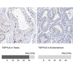 Invitrogen TSPYL6 Polyclonal Antibody 100 &mu;L; Unconjugated:Antibodies,