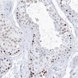 Invitrogen TSPYL6 Polyclonal Antibody 100 &mu;L; Unconjugated:Antibodies,