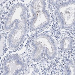 Invitrogen TSPYL6 Polyclonal Antibody 100 &mu;L; Unconjugated:Antibodies,