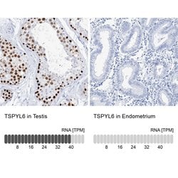 Invitrogen TSPYL6 Polyclonal Antibody 100 &mu;L; Unconjugated:Antibodies,