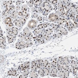 Invitrogen HEMK1 Polyclonal Antibody 100 &mu;L; Unconjugated:Antibodies,