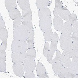 Invitrogen PSD4 Polyclonal Antibody 100 &mu;L | Buy Online | Invitrogen&trade; | Fisher Scientific