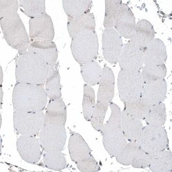 Invitrogen PSD4 Polyclonal Antibody 100 &mu;L; Unconjugated:Antibodies,