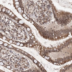 Invitrogen C3orf38 Polyclonal Antibody 100 &mu;L; Unconjugated:Antibodies,
