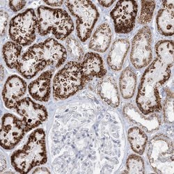 Invitrogen TBC1D7 Polyclonal Antibody 100 &mu;L; Unconjugated:Antibodies,