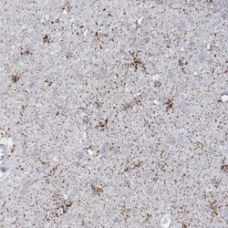 Invitrogen TBC1D7 Polyclonal Antibody 100 &mu;L; Unconjugated:Antibodies,