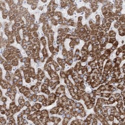 Invitrogen TBC1D7 Polyclonal Antibody 100 &mu;L; Unconjugated:Antibodies,