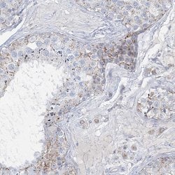 Invitrogen TBC1D7 Polyclonal Antibody 100 &mu;L; Unconjugated:Antibodies,