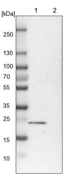 Invitrogen TBC1D7 Polyclonal Antibody 100 &mu;L; Unconjugated:Antibodies,