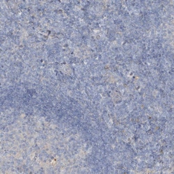 Invitrogen SLC4A10 Polyclonal Antibody 100 &mu;L; Unconjugated:Antibodies,