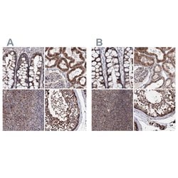 Invitrogen GFM1 Polyclonal Antibody 100 μL; Unconjugated:Antibodies,