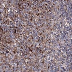 Invitrogen GFM1 Polyclonal Antibody 100 μL; Unconjugated:Antibodies,