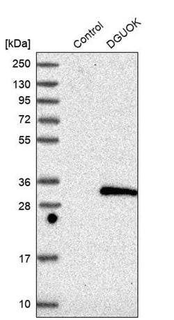 Invitrogen DGUOK Polyclonal Antibody 100 &mu;L; Unconjugated:Antibodies,