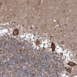 Invitrogen JIP2 Polyclonal Antibody 100 &mu;L; Unconjugated:Antibodies,