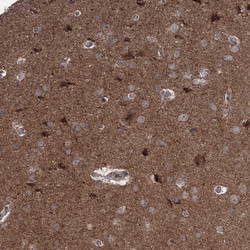 Invitrogen JIP2 Polyclonal Antibody 100 &mu;L; Unconjugated:Antibodies,