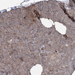 Invitrogen JIP2 Polyclonal Antibody 100 &mu;L; Unconjugated:Antibodies,