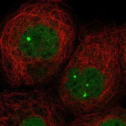 Invitrogen ZNF8 Polyclonal Antibody 100 &mu;L; Unconjugated:Antibodies,