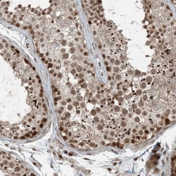 Invitrogen TTC15 Polyclonal Antibody 100 &mu;L; Unconjugated:Antibodies,