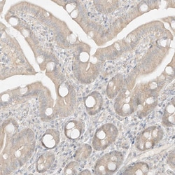 Invitrogen LIPT1 Polyclonal Antibody 100 &mu;L | Buy Online | Invitrogen&trade; | Fisher Scientific