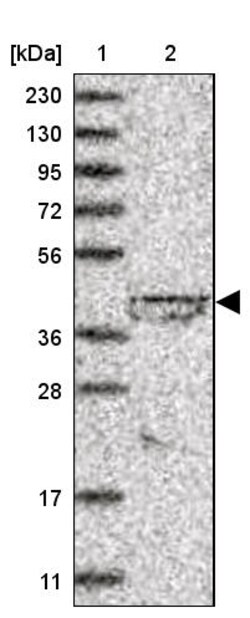 Invitrogen LIPT1 Polyclonal Antibody 100 &mu;L | Buy Online | Invitrogen&trade; | Fisher Scientific