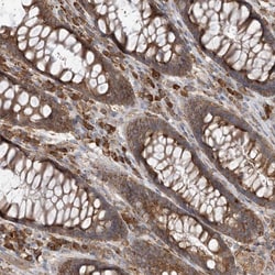 Invitrogen ACAP2 Polyclonal Antibody 100 &mu;L; Unconjugated:Antibodies,