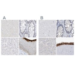 Invitrogen ASPRV1 Polyclonal Antibody 100 &mu;L; Unconjugated:Antibodies,