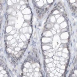 Invitrogen ASPRV1 Polyclonal Antibody 100 &mu;L; Unconjugated:Antibodies,
