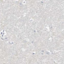 Invitrogen ASPRV1 Polyclonal Antibody 100 &mu;L; Unconjugated:Antibodies,