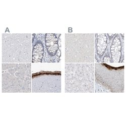 Invitrogen ASPRV1 Polyclonal Antibody 100 &mu;L; Unconjugated:Antibodies,