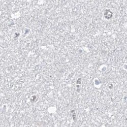 Invitrogen ASPRV1 Polyclonal Antibody 100 &mu;L; Unconjugated:Antibodies,