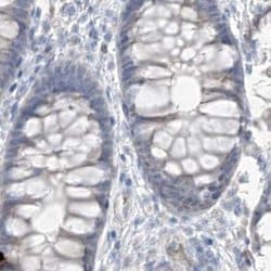 Invitrogen ASPRV1 Polyclonal Antibody 100 &mu;L; Unconjugated:Antibodies,