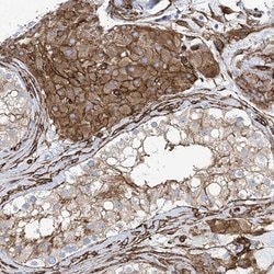 Invitrogen UBTD1 Polyclonal Antibody 100 &mu;L; Unconjugated:Antibodies,