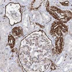 Invitrogen UBTD1 Polyclonal Antibody 100 &mu;L; Unconjugated:Antibodies,
