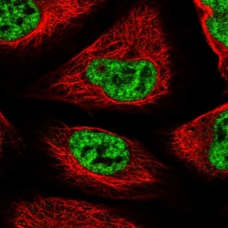 Invitrogen SF3B14 Polyclonal Antibody 100 &mu;L; Unconjugated:Antibodies,