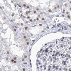 Invitrogen SF3B14 Polyclonal Antibody 100 &mu;L; Unconjugated:Antibodies,