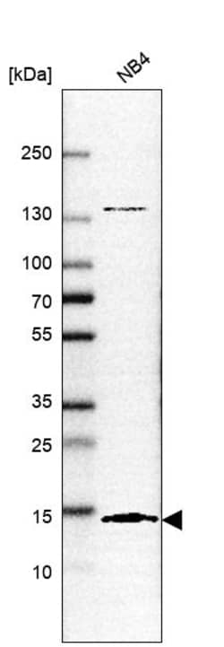 Invitrogen SF3B14 Polyclonal Antibody 100 &mu;L; Unconjugated:Antibodies,