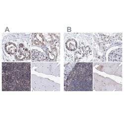 Invitrogen SF3B14 Polyclonal Antibody 100 &mu;L; Unconjugated:Antibodies,