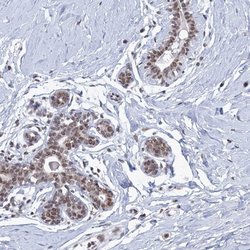 Invitrogen SF3B14 Polyclonal Antibody 100 &mu;L; Unconjugated:Antibodies,