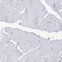 Invitrogen SF3B14 Polyclonal Antibody 100 &mu;L; Unconjugated:Antibodies,