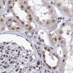 Invitrogen SF3B14 Polyclonal Antibody 100 &mu;L; Unconjugated:Antibodies,