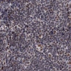 Invitrogen SF3B14 Polyclonal Antibody 100 &mu;L; Unconjugated:Antibodies,