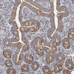 Invitrogen GTPBP8 Polyclonal Antibody 100 &mu;L; Unconjugated:Antibodies,