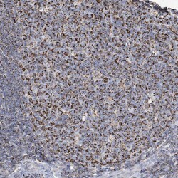 Invitrogen GTPBP8 Polyclonal Antibody 100 &mu;L; Unconjugated:Antibodies,
