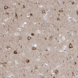 Invitrogen GTPBP8 Polyclonal Antibody 100 &mu;L; Unconjugated:Antibodies,