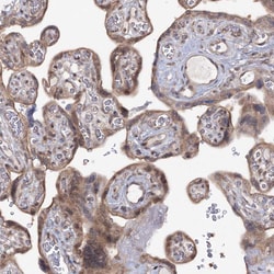 Invitrogen ZFAND6 Polyclonal Antibody 100 &mu;L; Unconjugated:Antibodies,
