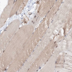 Invitrogen ZFAND6 Polyclonal Antibody 100 &mu;L; Unconjugated:Antibodies,
