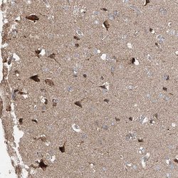 Invitrogen UQCC1 Polyclonal Antibody 100 &mu;L; Unconjugated:Antibodies,