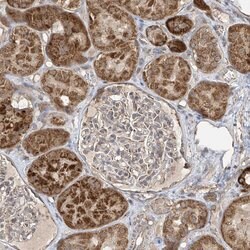 Invitrogen UQCC1 Polyclonal Antibody 100 &mu;L; Unconjugated:Antibodies,