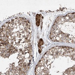 Invitrogen UQCC1 Polyclonal Antibody 100 &mu;L; Unconjugated:Antibodies,